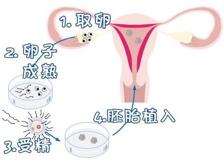 关于{ k1=g1 }